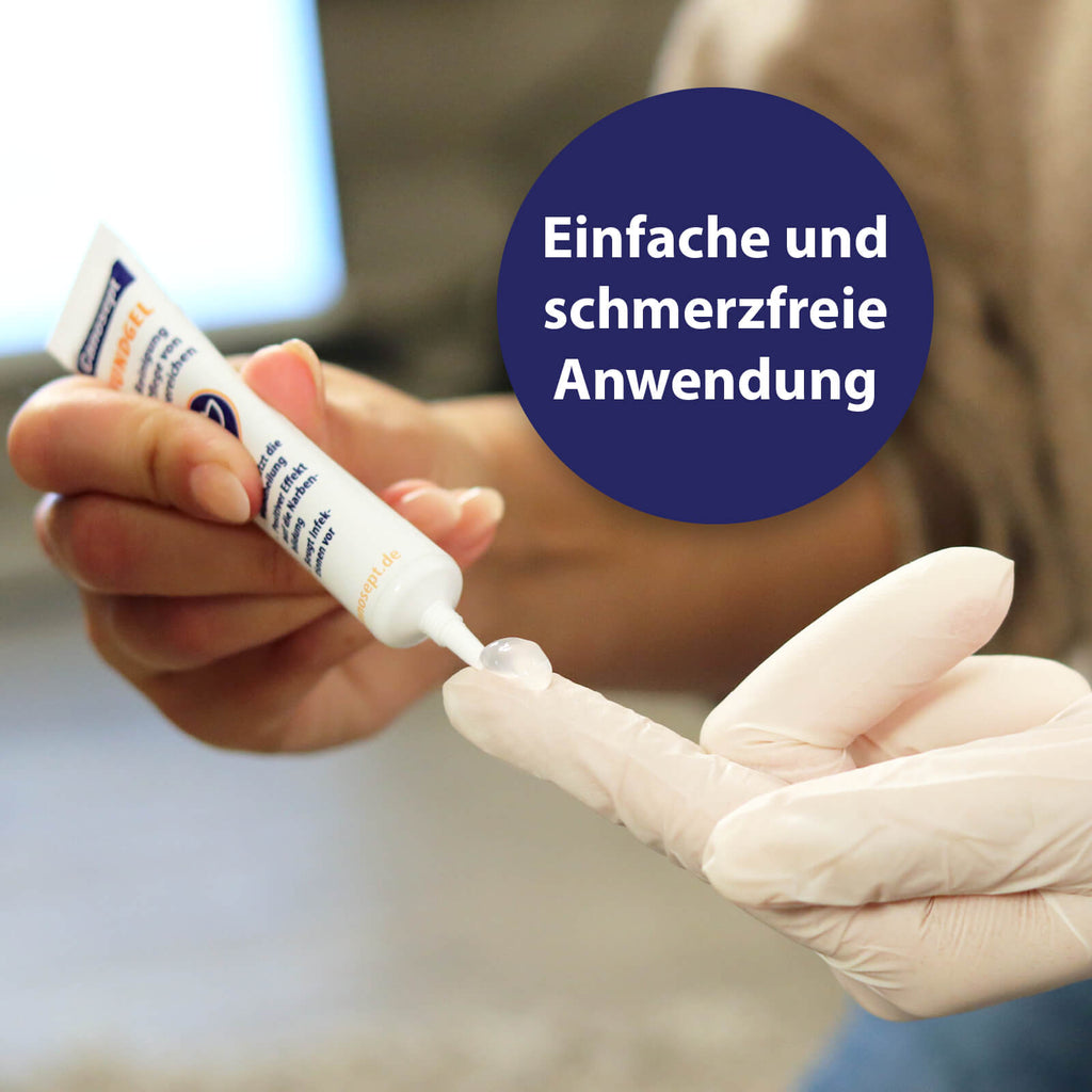 Wundgel wird auf Finger aufgetragen -Einfache und schmerzfreie Anwendung